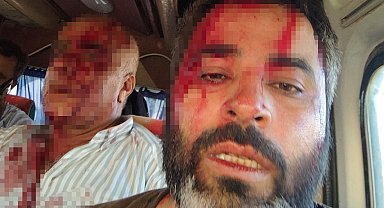 Akçakale'de meydan savaşı gibi kavga: 8 yaralı