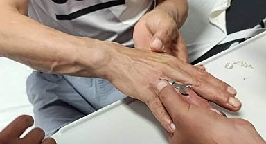 Antakya'da vatandaşın parmağına sıkışan yüzüğü itfaiye çıkardı