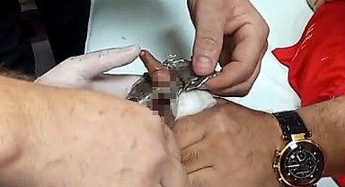 Bitlis'te parmağı çelik halkaya sıkışan çocuk itfaiye ekiplerince kurtarıldı