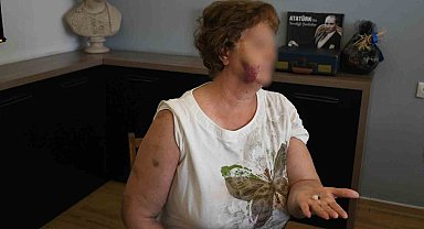Kuşadası'nda ev kavgası kanlı bitti: Anne ve iki çocuğu bıçaklandı