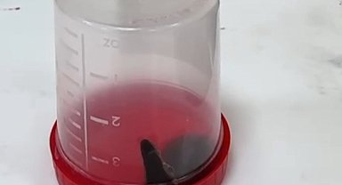 Siirt te 6 yaşındaki çocuğun boğazından sülük çıktı