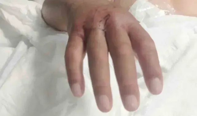 Hatay'da çiftçiyi narenciye toplarken yılan soktu