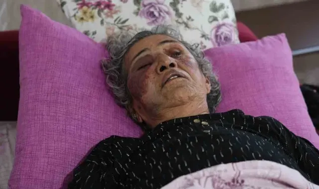 Yaşlı kadını yüzüğü için öldüresiye darbetti