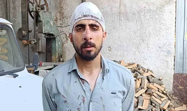 Şanlıurfa'da trafikte yavaş giden sürücüye meydan dayağı: Burnu kırıldı, başına 8 dikiş atıldı