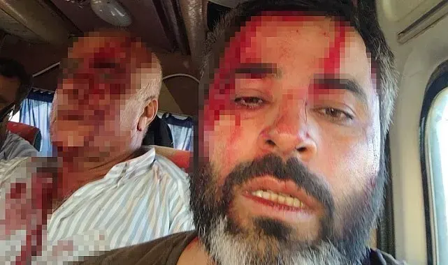 Akçakale'de meydan savaşı gibi kavga: 8 yaralı