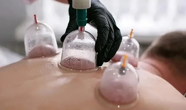 Hacamat uygulaması hekim kontrolü ve steril ortamda yapılmalı