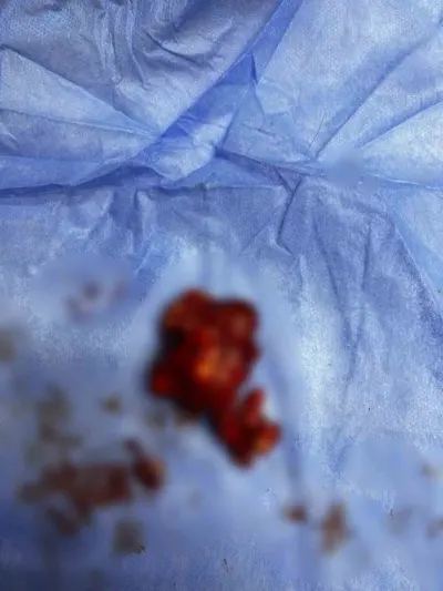 Bilecik'te Meme Tümörü Geçiren Sokak Köpeği Sağlığına Kavuştu