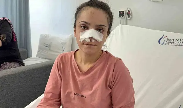 Eşinin kopardığı burnu başarılı operasyonla yerine dikildi