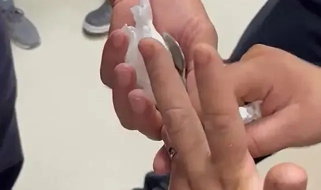 Yüzüğü parmağına sıkışan kadının yardımına itfaiye koştu