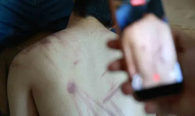 Down sendromlu oğlunun vücudundaki izleri görünce soluğu önce hastanede ardından adliyede aldı
