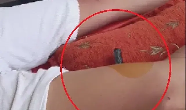 Bahçeye kaçan topu almak isteyen çocuğun bacağına korkuluk demiri saplandı