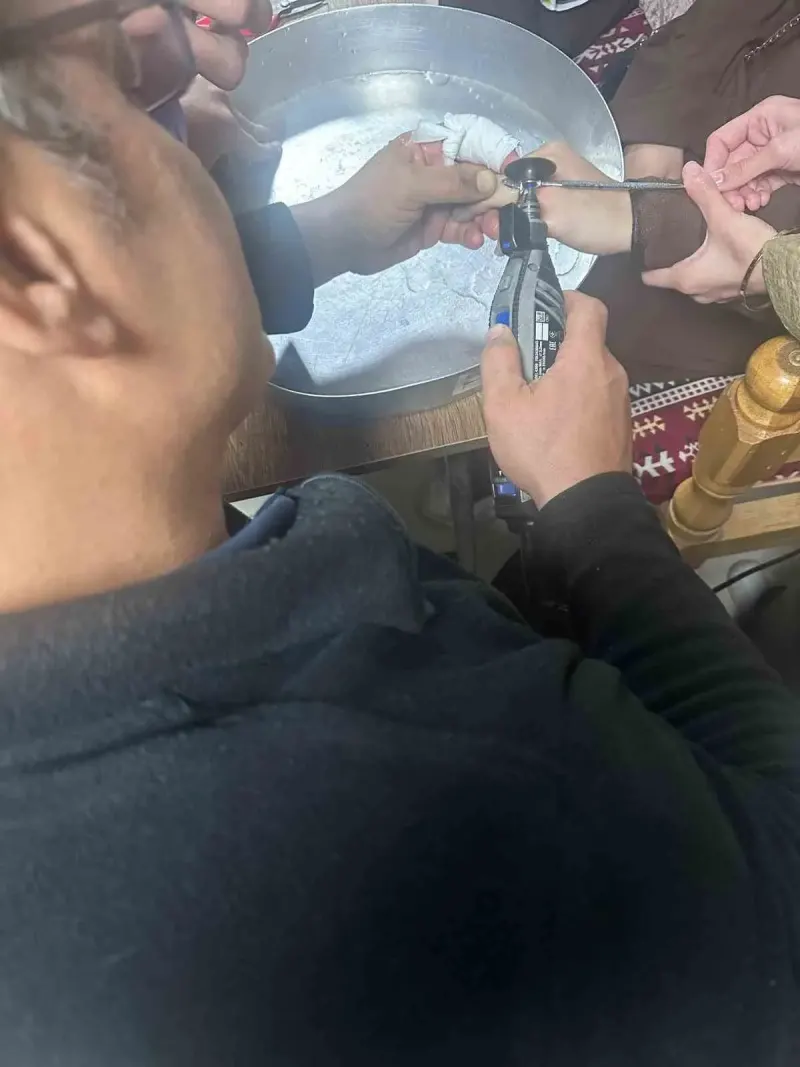 Batman'da Parmağına Yüzük Sıkışan Vatandaş Hastanede Kurtarıldı