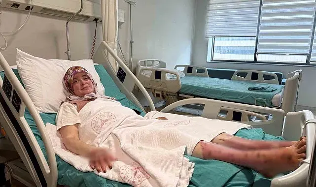 Karavandaki patlama sonrası vücudunun yüzde 70'i yandı: "Karadeniz turu yapacaktık, alev topuna döndüm"