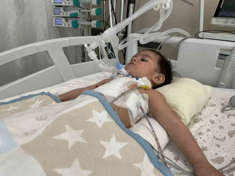 Konya'da Ceviz Yutan 1 Yaşındaki Bebek ECMO Cihazıyla Hayata Tutundu