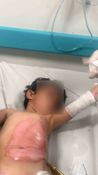Şırnak'ta Evde Kaza: Kaynar Su Dökülen Küçük Çocuk Hastaneye Kaldırıldı