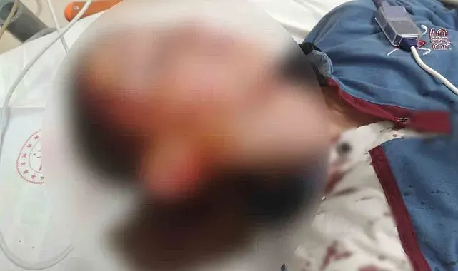Köpek saldırısında yaralanan çocuk için 1 milyon 200 bin tazminat