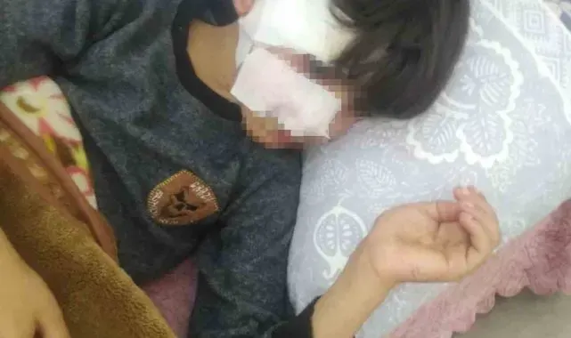 Gaziantep'te 8 yaşındaki çocuğa 5 sokak köpeği saldırdı