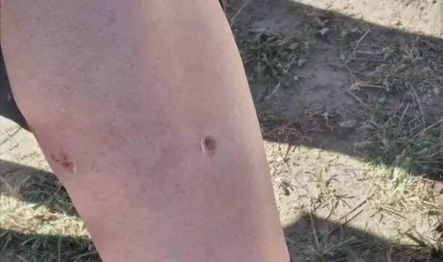 Germencik'te yaşlı adama köpekler saldırdı